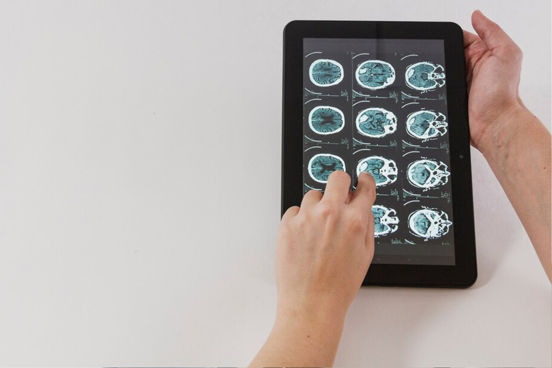 Travmatik Beyin Yaralanması Fizyoterapi